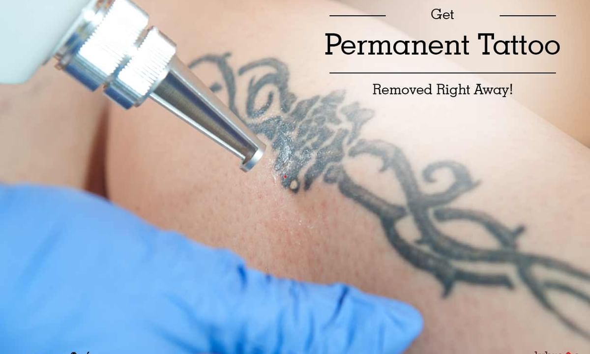 How to Remove Permanent Tattoo 10 Effective Ways to Try