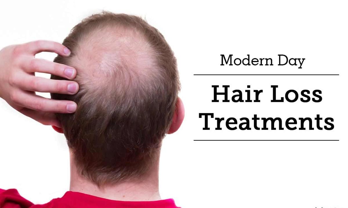 Modern Day Hair Loss Treatments - By Dr. Mukesh Batra | Lybrate