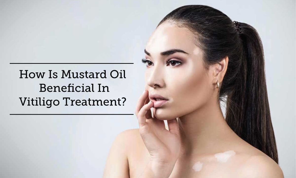 How Is Mustard Oil Beneficial In Vitiligo Treatment? - By Dr. Ravish Kamal  | Lybrate