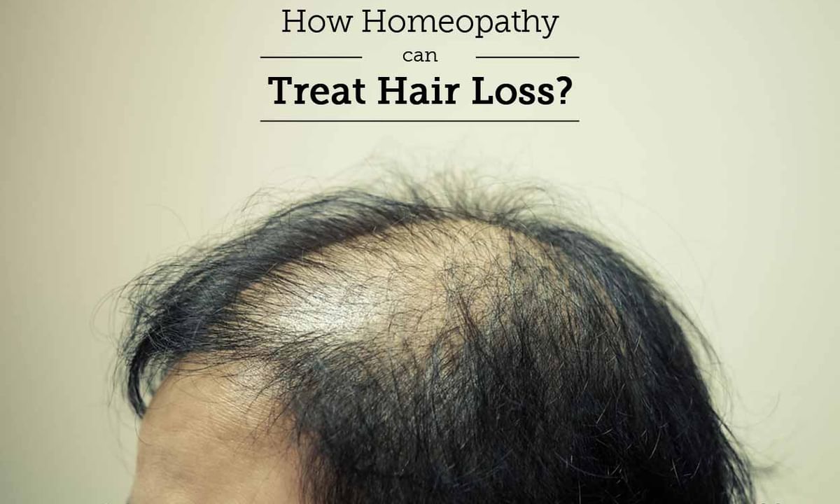 How Homeopathy Can Treat Hair Loss? - By Dr. Swapan Debnath | Lybrate