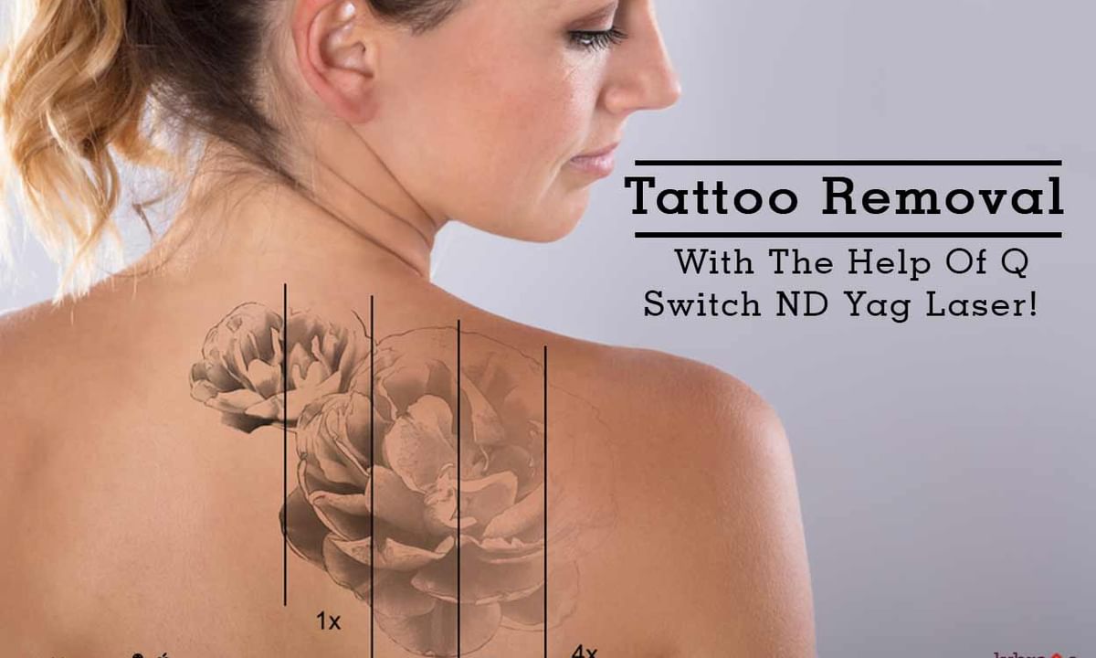 How To Treat Tattoo Removal Infection  Tattoo Removal Institute