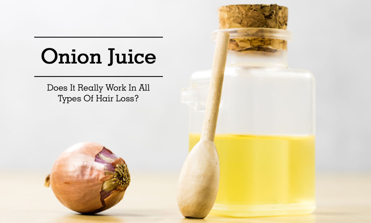 Onion Juice - Does It Really Work In All Types Of Hair Loss? - By Dr. Rohit  Shah | Lybrate