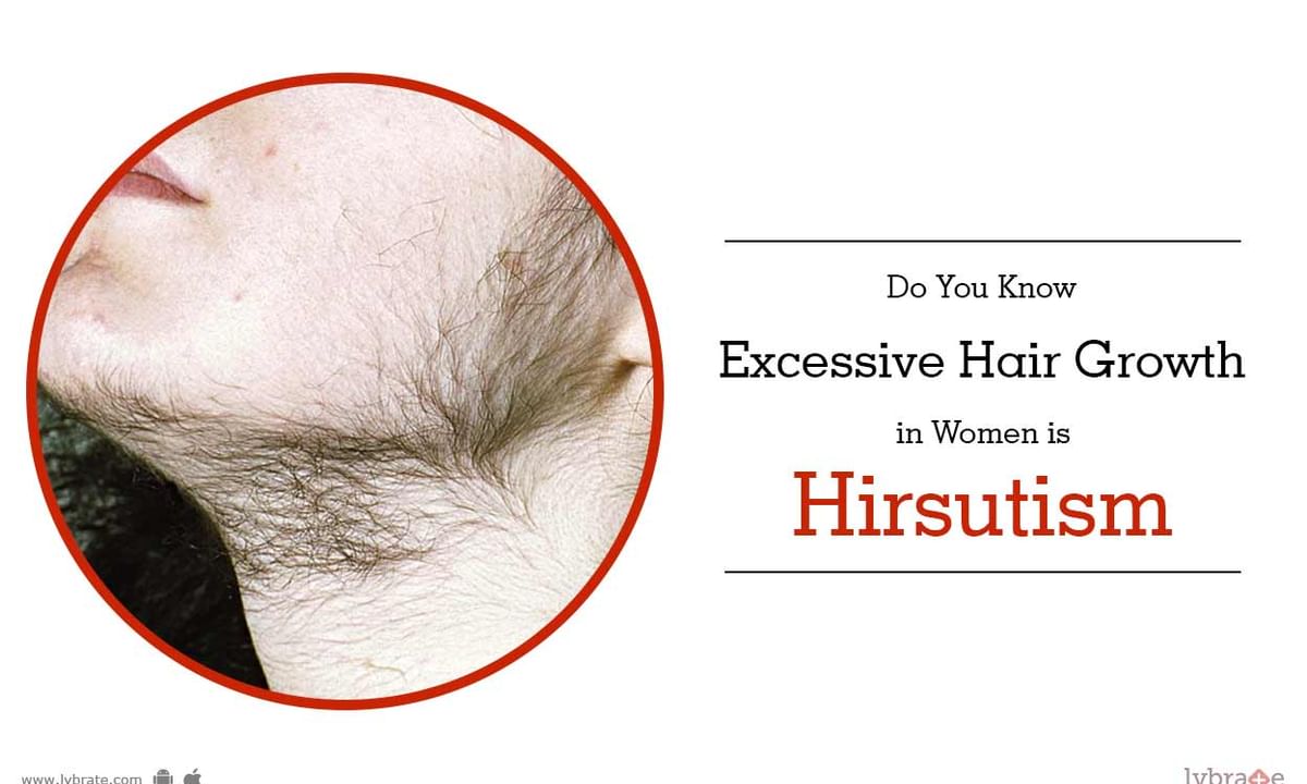 Do You Know Excessive Hair Growth in Women is Hirsutism - By Dr. Parul  Katiyar | Lybrate