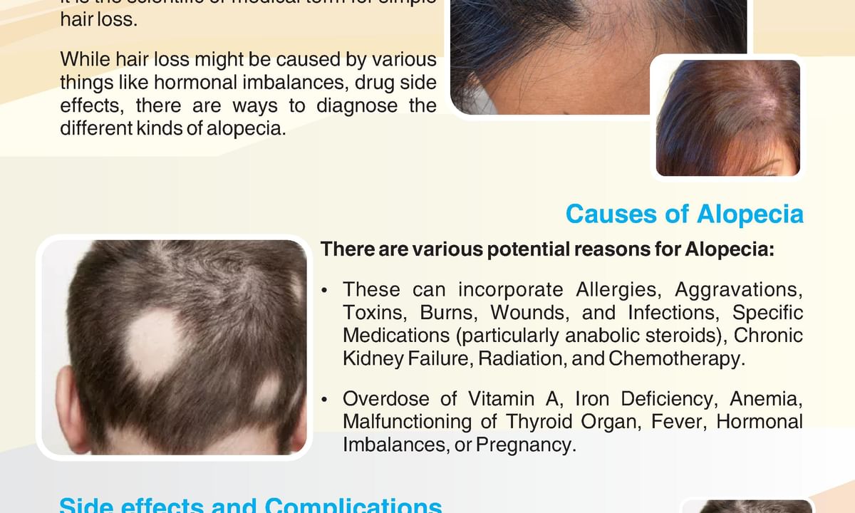 What is Alopecia Hair Loss - Types/Causes/Diagnosis and Treatment - By  Looks Forever Hair And Skin Aesthetic Clinic | Lybrate