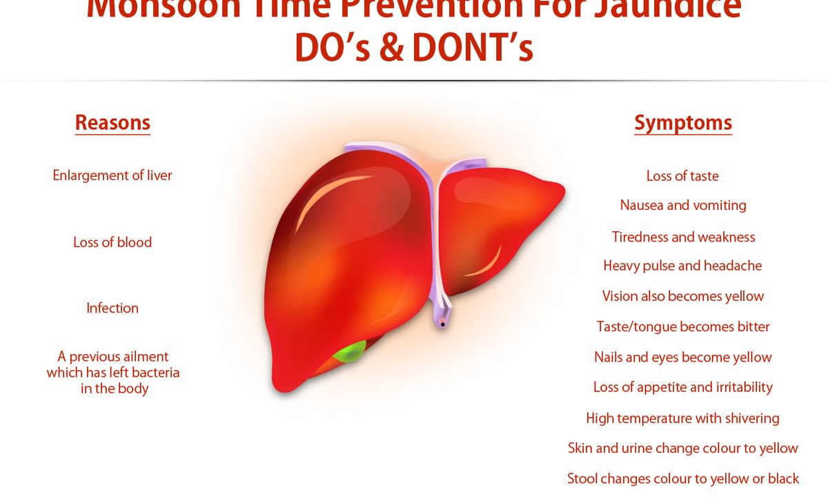 Monsoon Time Prevention For Jaundice: DO's & DONT's - By Dr. Amit Singhal | Lybrate Monsoon Time Prevention For Jaundice: DO's & DONT's - By Dr. Amit Singhal | Lybrate