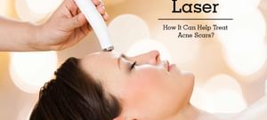 Laser Treatment For Acne Scars Procedure Cost Recovery Side