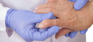 hogyan kezeljük a sarkot rheumatoid arthritisben