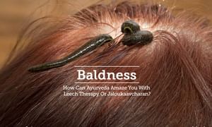 Baldness - How Can Ayurveda Amaze You With Leech Therapy Or  Jaloukaavcharan? | Lybrate