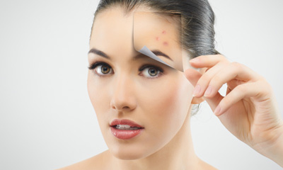 All About Acne