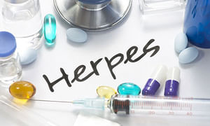Herpes And Unprotected Sex