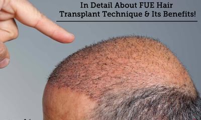 I spent over 6K on a hair transplant  and people are shocked