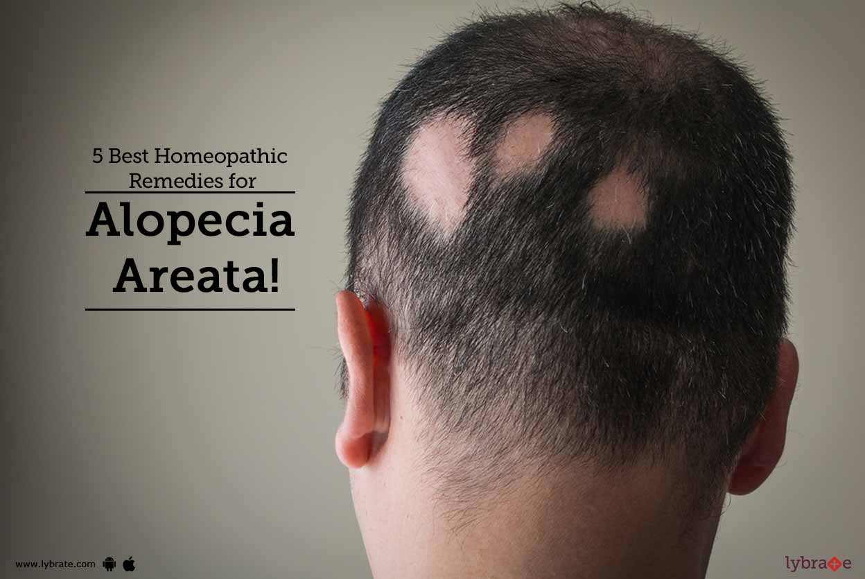 homeopathic treatment for alopecia in cats