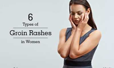 6 Types Of Groin Rashes In Women