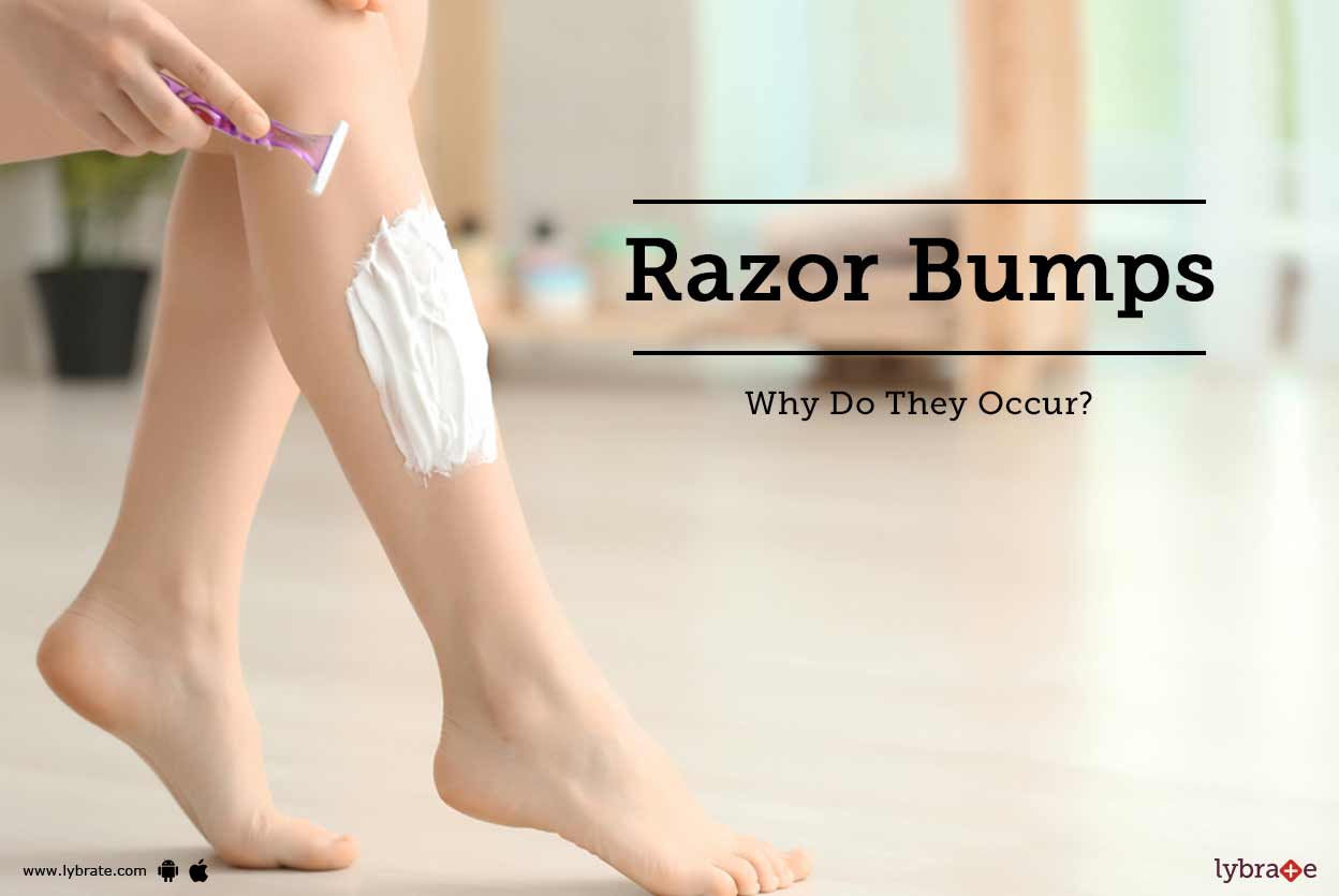 Razor Bumps Why Do They Occur By Dr Akhilesh Lybrate
