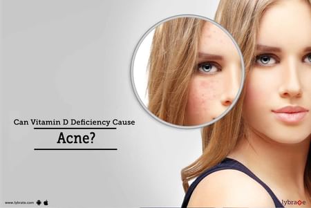 Can Vitamin D Deficiency Cause Acne By Dr Nivedita Dadu