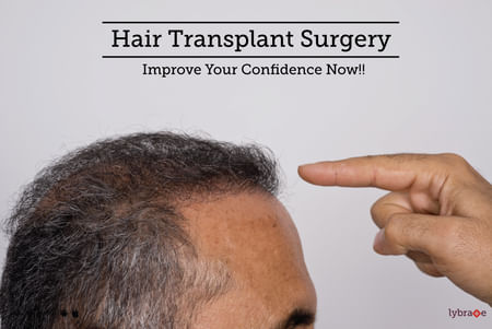 Hair Transplant Surgery - Improve Your Confidence Now!! - By Dr. Anubhav  Gupta | Lybrate