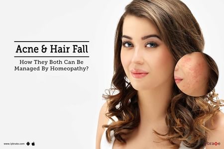 Acne & Hair Fall - How They Both Can Be Managed By Homeopathy? - By Dr.  Prashant K Vaidya | Lybrate