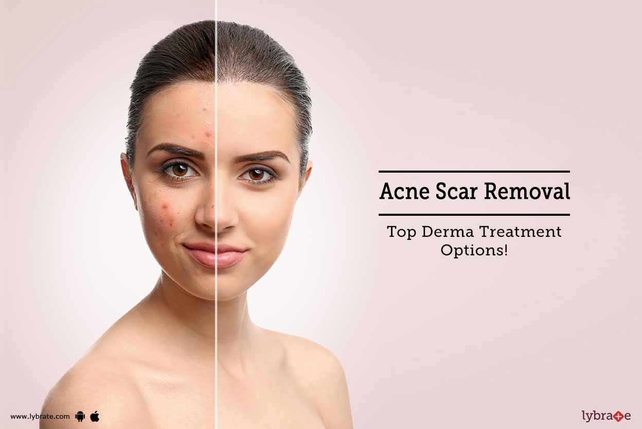 derma cream for scars