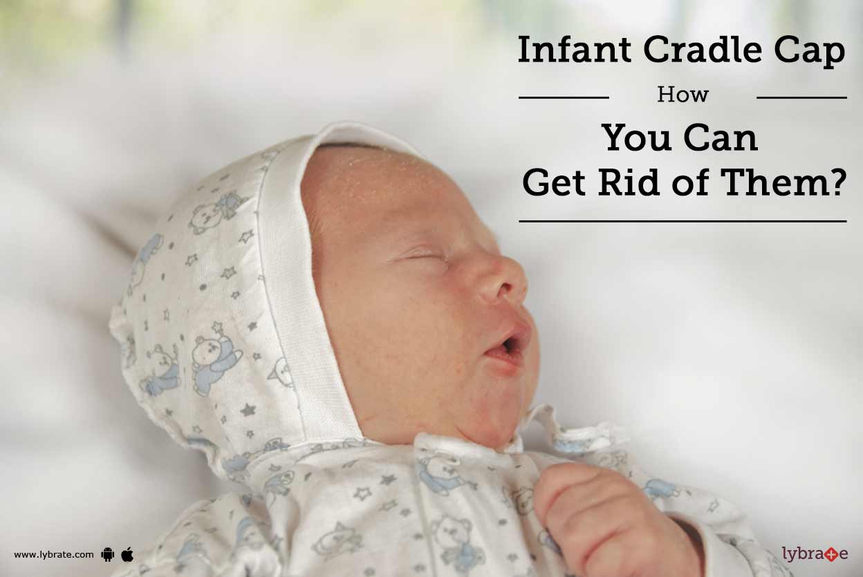 ketoconazole cream for cradle cap