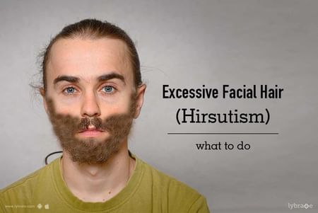 Excessive Facial Hair (Hirsutism) - What to Do - By Dr. Rohit Batra | Lybrate Excessive Facial Hair (Hirsutism) - What to Do - By Dr. Rohit Batra | Lybrate