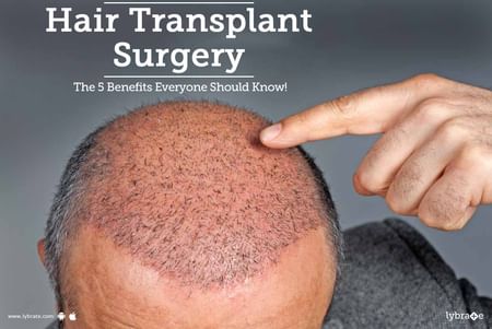 Hair Transplant Surgery- The 5 Benefits Everyone Should Know! - By Dr. Shobha Jindal | Lybrate Hair Transplant Surgery- The 5 Benefits Everyone Should Know! - By Dr. Shobha Jindal | Lybrate