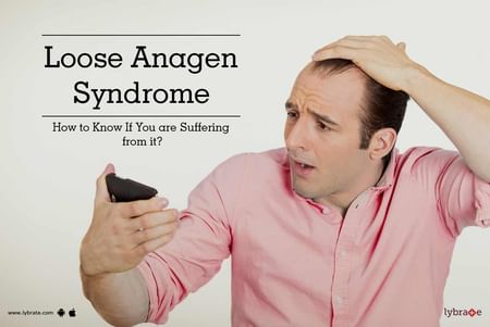 Loose Anagen Syndrome How To Know If You Are Suffering From It