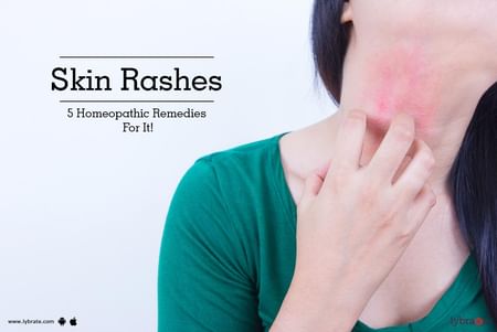 Fatty Liver Disease Rash - Herbs and Food Recipes