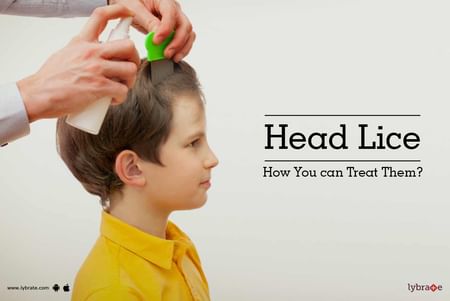 Head Lice - How You can Treat Them? - By Dr. Rashmi Mittal | Lybrate Head Lice - How You can Treat Them? - By Dr. Rashmi Mittal | Lybrate