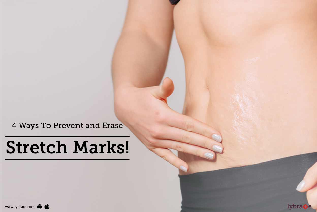 tretinoin cream 0.025 for stretch marks