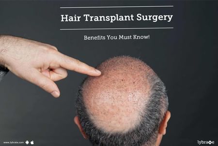 Best Hair Transplant In Hyderabad