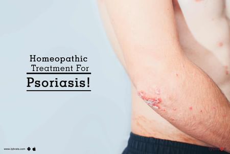 surgery in patients with psoriasis)