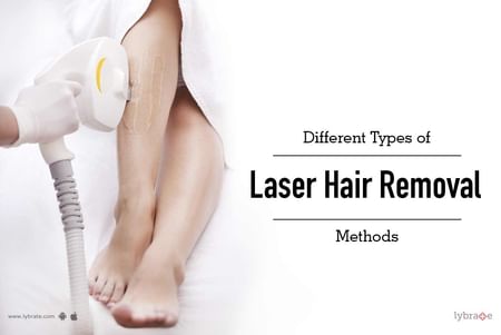 laser hair removal methods
