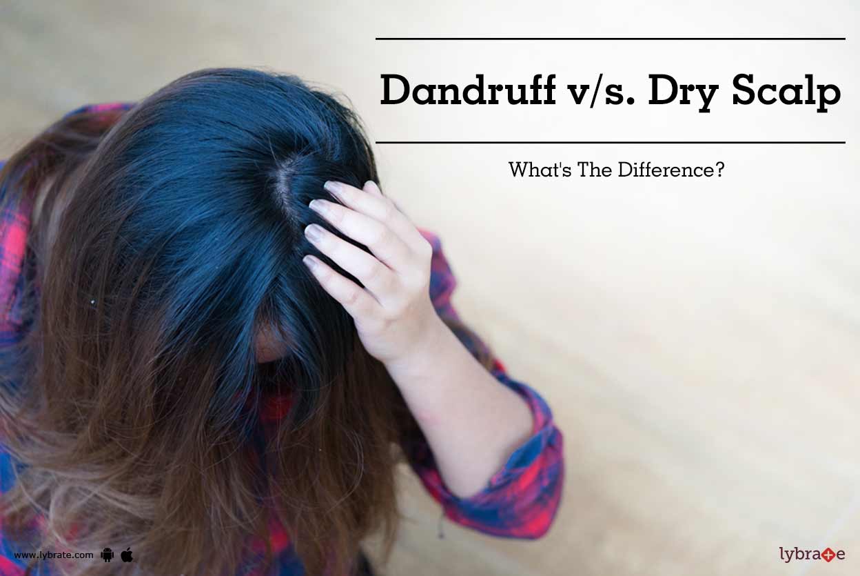 Dandruff V S Dry Scalp What S The Difference By Dr Kanu