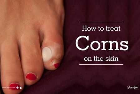 best way to treat corns on toes