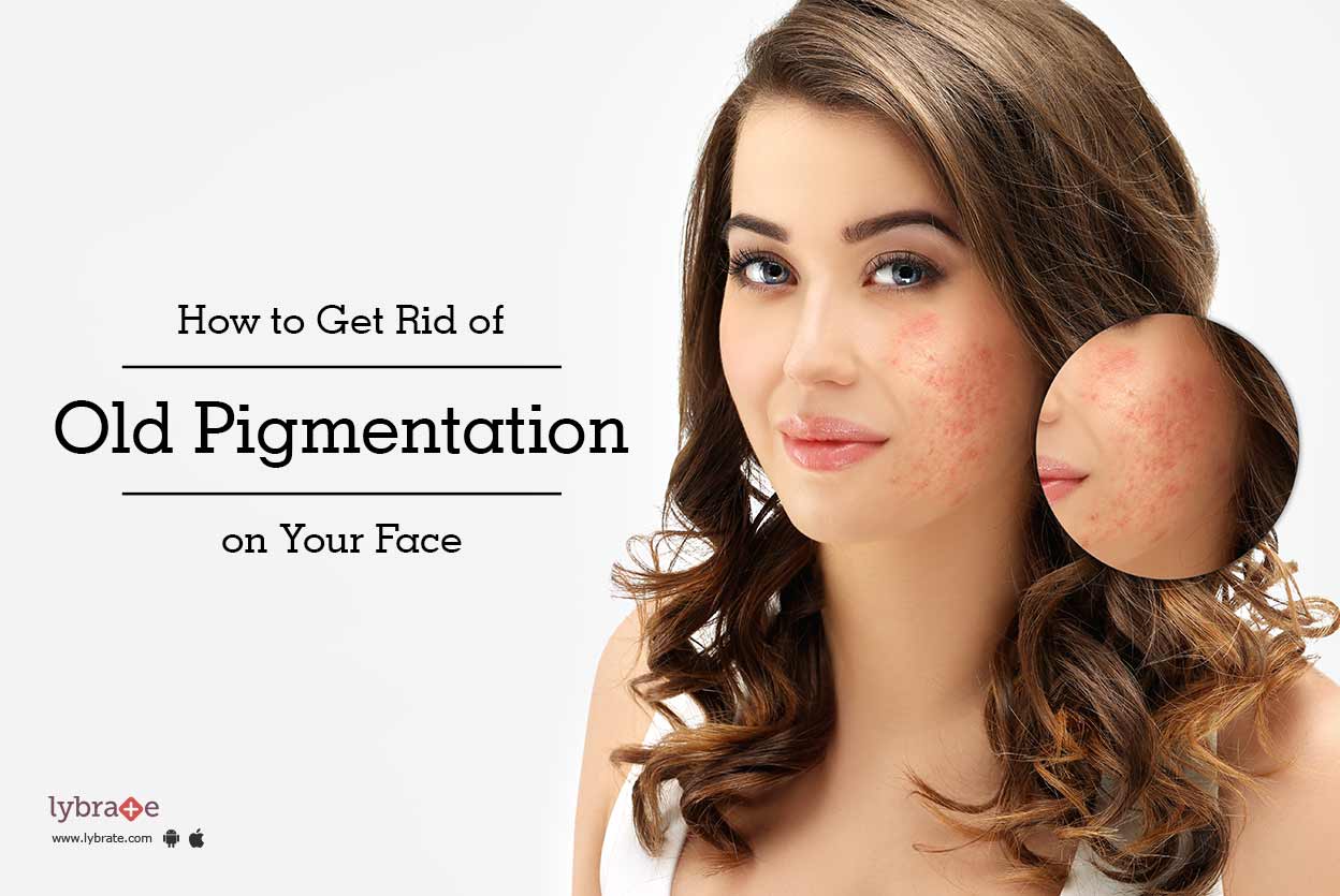 pigmentation images on face