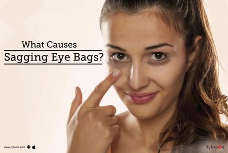 schieten Vertrek naar enkel en alleen What Causes Sagging Eye Bags? - By Dr. Amit Mukund Mulay | Lybrate