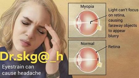 Ce este miopia și ce facem ca să o evităm | SanoTeca, Miopia medicina populara