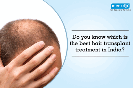 Do you know which is the best hair transplant treatment in India? - By  Richfeel | Lybrate