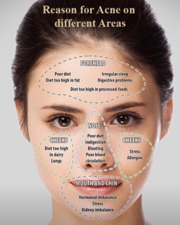 dieta anti acne rosacea dieta anti acne rosacea