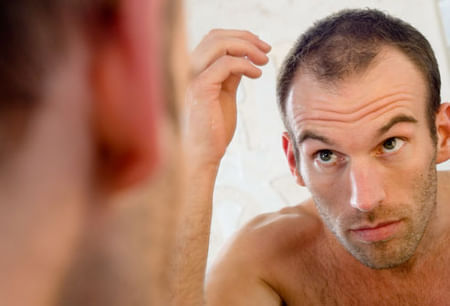 What to do when balding young