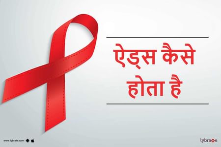 Aids Kaise Hota Hai in Hindi - ऐड्स कैसे होता है