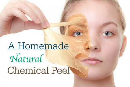 homemade chemical peel facials