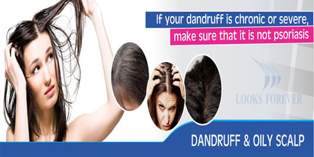 Eliminate Dandruff In Just 3 Steps By Looks Forever Hair And