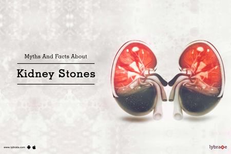 Myths And Facts About Kidney Stones By Dr Garima Sharma Lybrate