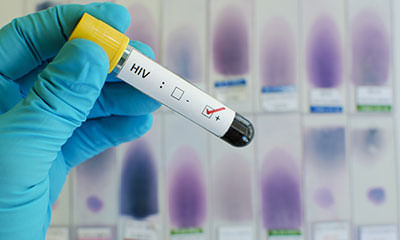 hiv duo test accurate 4 weeks