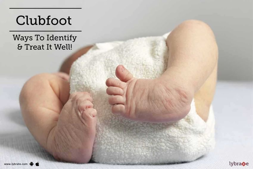 Treatment For Children Born With Clubfeet By Dr Nargesh Agrawal Lybrate