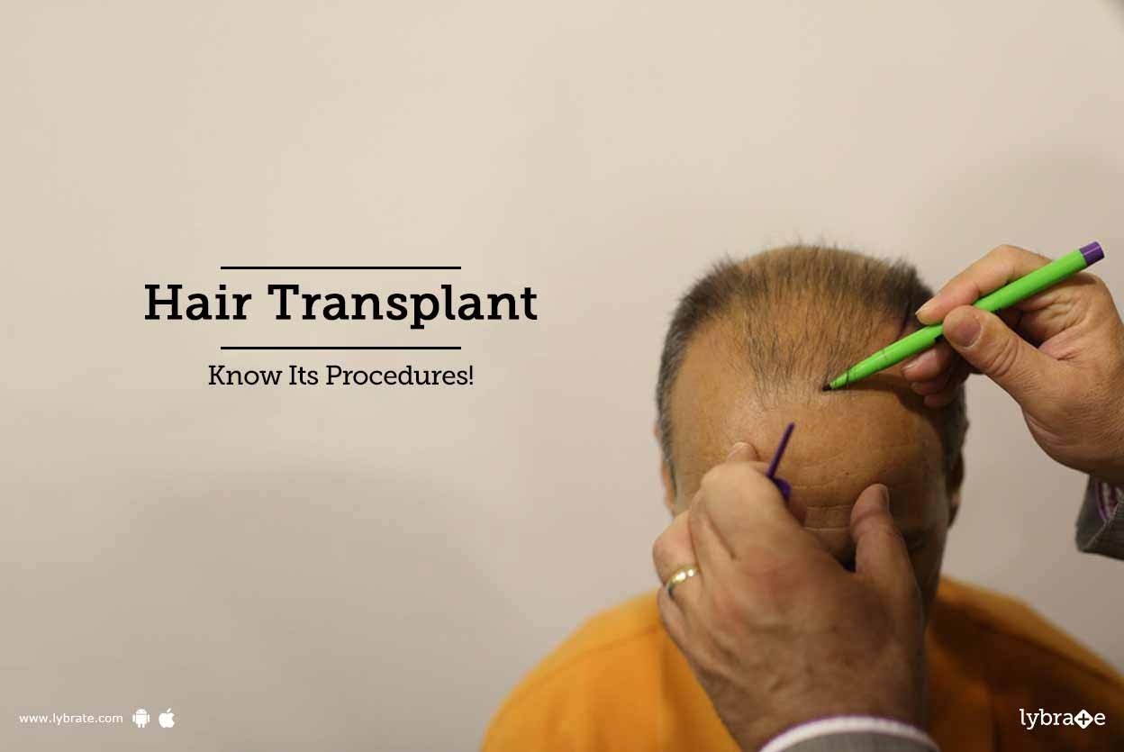 Robotic Hair Transplant Articles Health Tips Questions
