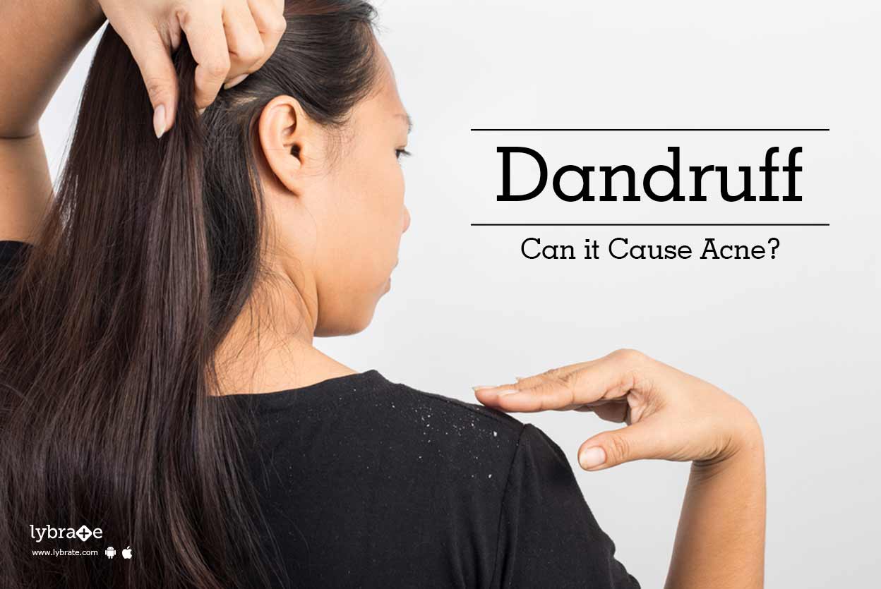 Dandruff Treatment Tips Advice From Top Doctors Lybrate Page 4