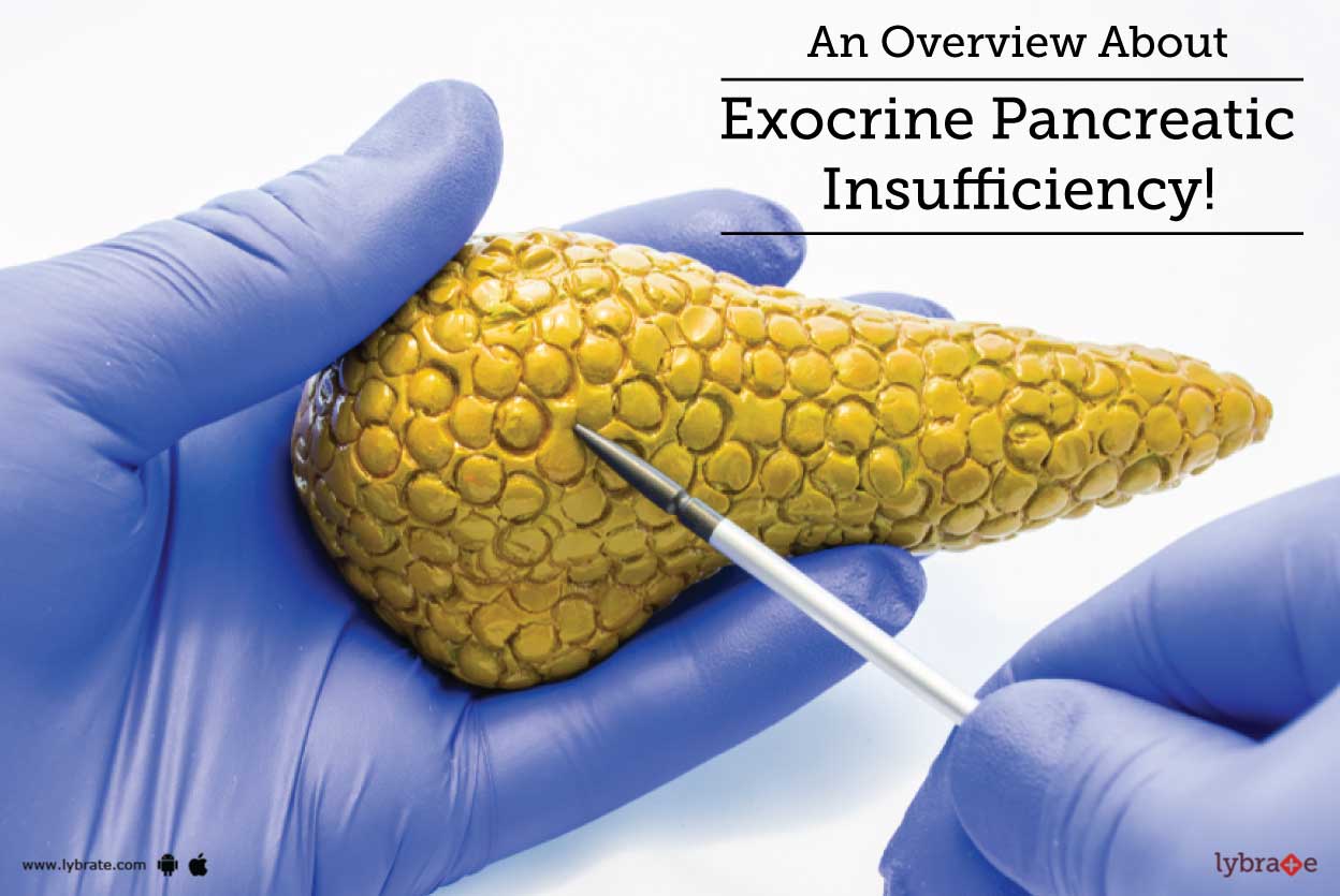 An Overview About Exocrine Pancreatic Insufficiency By Dr Lovkesh Anand Lybrate
