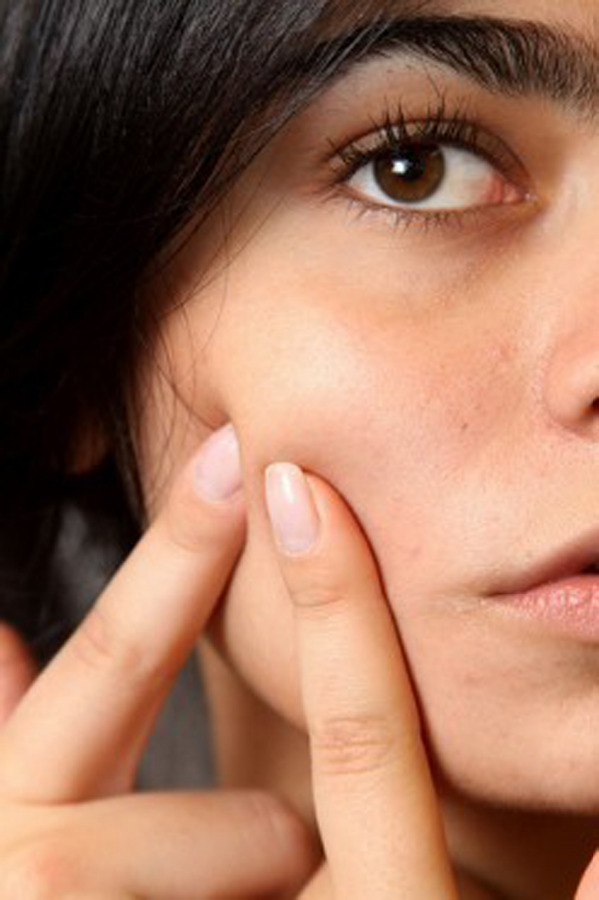 How to fight with pesky pimples How to fight with pesky pimples